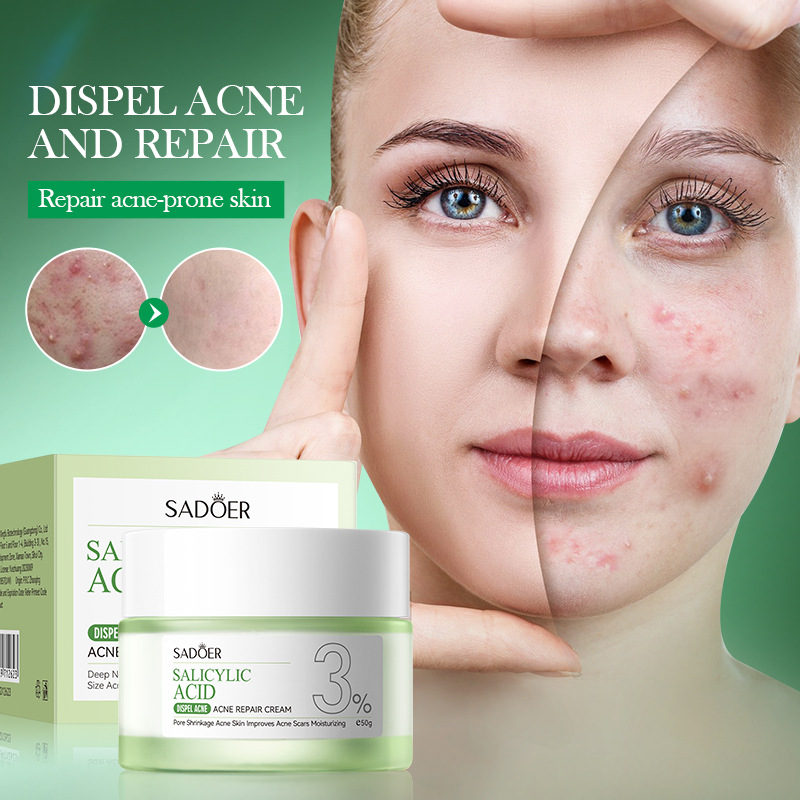 Crème de traitement de l'acné  - Salicylic Acid Blackhead Remover avis et prix